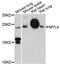 Myosin Light Chain 4 antibody, LS-C748309, Lifespan Biosciences, Western Blot image 