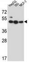 Lipase Family Member J antibody, AP52496PU-N, Origene, Western Blot image 