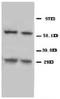 BCL2 Interacting Protein 3 antibody, AP23270PU-N, Origene, Western Blot image 