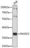 Ras Association Domain Family Member 2 antibody, 16-222, ProSci, Western Blot image 