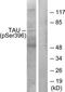 Microtubule Associated Protein Tau antibody, TA312285, Origene, Western Blot image 