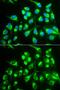 CT-1 antibody, GTX55800, GeneTex, Immunofluorescence image 