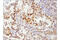 Forkhead Box O1 antibody, 97635S, Cell Signaling Technology, Immunohistochemistry paraffin image 