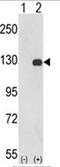 PTK2 antibody, AP18170PU-N, Origene, Western Blot image 