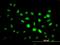 PHD Finger Protein 1 antibody, H00005252-M04, Novus Biologicals, Immunocytochemistry image 