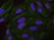 CTD small phosphatase-like protein antibody, NB100-2579, Novus Biologicals, Proximity Ligation Assay image 