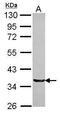 Tripartite Motif Containing 17 antibody, PA5-30615, Invitrogen Antibodies, Western Blot image 
