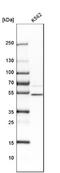 Ubiquitin Protein Ligase E3 Component N-Recognin 3 antibody, NBP1-87996, Novus Biologicals, Western Blot image 