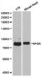 X-linked retinitis pigmentosa GTPase regulator antibody, TA327197, Origene, Western Blot image 