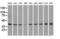 Mitogen-Activated Protein Kinase 1 antibody, GTX84153, GeneTex, Western Blot image 