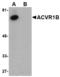 Activin A Receptor Type 1 antibody, LS-B2695, Lifespan Biosciences, Western Blot image 