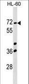 Calicin antibody, LS-C159292, Lifespan Biosciences, Western Blot image 
