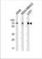 Growth factor receptor-bound protein 10 antibody, TA325016, Origene, Western Blot image 