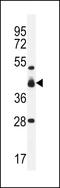 V-set and immunoglobulin domain-containing protein 8 antibody, LS-C160548, Lifespan Biosciences, Western Blot image 