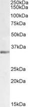 Lactate Dehydrogenase C antibody, NB100-68160, Novus Biologicals, Western Blot image 