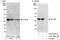 Zinc Finger CCCH-Type Containing 8 antibody, A303-089A, Bethyl Labs, Western Blot image 