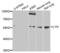 LYN Proto-Oncogene, Src Family Tyrosine Kinase antibody, orb135859, Biorbyt, Western Blot image 
