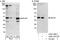 BRCA2 and CDKN1A-interacting protein antibody, A302-196A, Bethyl Labs, Western Blot image 