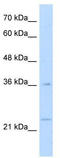 MAF BZIP Transcription Factor B antibody, TA334222, Origene, Western Blot image 
