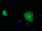 Short Chain Dehydrogenase/Reductase Family 9C Member 7 antibody, LS-C115649, Lifespan Biosciences, Immunofluorescence image 
