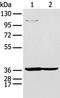 Nudix Hydrolase 19 antibody, PA5-51352, Invitrogen Antibodies, Western Blot image 