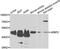 Zinc finger protein AEBP2 antibody, A7400, ABclonal Technology, Western Blot image 