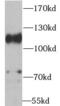 ADAM 17 antibody, FNab00138, FineTest, Western Blot image 