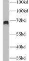 Guanylate Binding Protein 2 antibody, FNab03374, FineTest, Western Blot image 