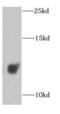 Cytochrome C Oxidase Subunit 6A1 antibody, FNab01902, FineTest, Western Blot image 