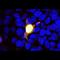 Cas9 antibody, M30929-2, Boster Biological Technology, Immunohistochemistry paraffin image 