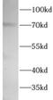 WEE1 G2 Checkpoint Kinase antibody, FNab10017, FineTest, Western Blot image 