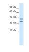 One Cut Homeobox 3 antibody, NBP1-91529, Novus Biologicals, Western Blot image 