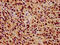 Zinc Finger Protein 224 antibody, LS-C681741, Lifespan Biosciences, Immunohistochemistry paraffin image 