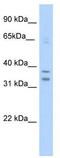 Nuclear Receptor Subfamily 1 Group I Member 3 antibody, TA341839, Origene, Western Blot image 