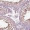 Von Willebrand Factor A Domain Containing 5B1 antibody, NBP2-57637, Novus Biologicals, Immunohistochemistry frozen image 