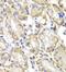 LYN Proto-Oncogene, Src Family Tyrosine Kinase antibody, FNab04903, FineTest, Immunohistochemistry paraffin image 