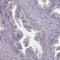 Sperm-associated antigen 8 antibody, HPA068012, Atlas Antibodies, Immunohistochemistry paraffin image 