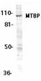 Mdm2-binding protein antibody, TA306073, Origene, Western Blot image 
