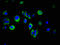 Serine Peptidase Inhibitor, Kunitz Type 2 antibody, LS-C674054, Lifespan Biosciences, Immunofluorescence image 