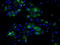 ATP Synthase F1 Subunit Beta antibody, TA500835, Origene, Immunofluorescence image 