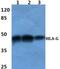 Major Histocompatibility Complex, Class I, G antibody, GTX66762, GeneTex, Western Blot image 
