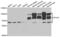 SP100 Nuclear Antigen antibody, abx004488, Abbexa, Western Blot image 