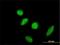 Sex comb on midleg-like protein 2 antibody, H00010389-M01, Novus Biologicals, Immunocytochemistry image 