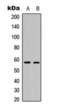 Tyrosine Hydroxylase antibody, orb393174, Biorbyt, Western Blot image 