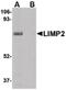 Limpii antibody, PA5-20540, Invitrogen Antibodies, Western Blot image 