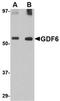 Nanos C2HC-Type Zinc Finger 2 antibody, orb75008, Biorbyt, Western Blot image 
