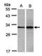 Enoyl-CoA Delta Isomerase 1 antibody, GTX104473, GeneTex, Western Blot image 