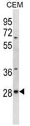 AlkB Homolog 4, Lysine Demethylase antibody, AP50150PU-N, Origene, Western Blot image 