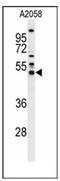 SERPINA1 antibody, AP53855PU-N, Origene, Western Blot image 