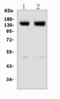 Glutamate Metabotropic Receptor 5 antibody, A01338-1, Boster Biological Technology, Western Blot image 